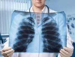 Apa Penyebab Banyaknya Lendir di Paru-paru?